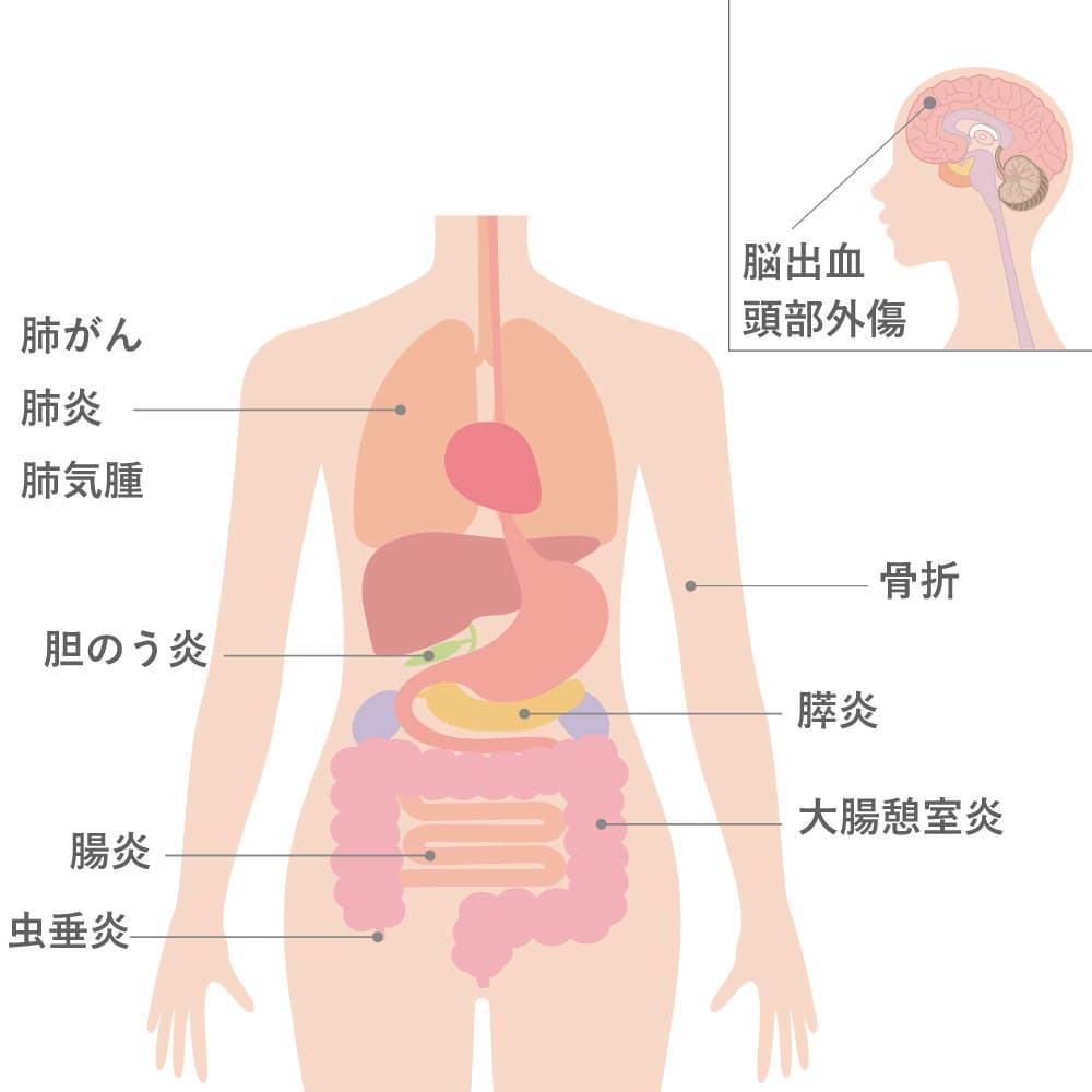 疾患図