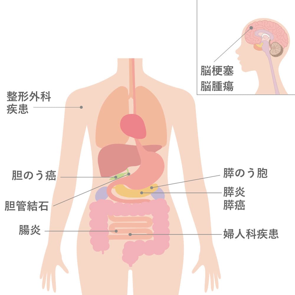 疾患図