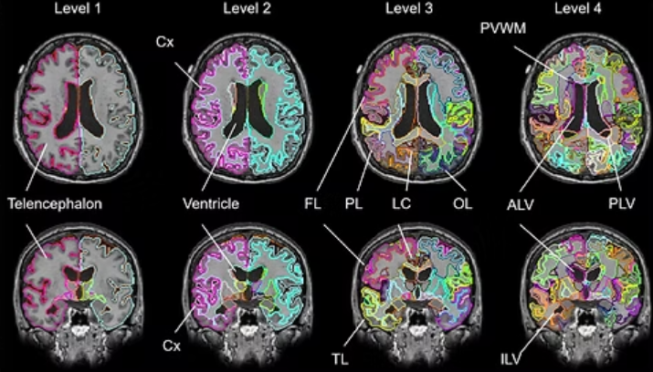 追加検討中　波さん専用 VarioSurg3（オーラルサージェリー）｜歯科医療機器のナカニシ